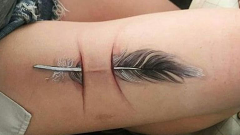 Scars